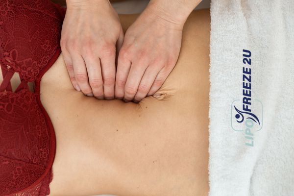 diastasis recti treatment Ashford
