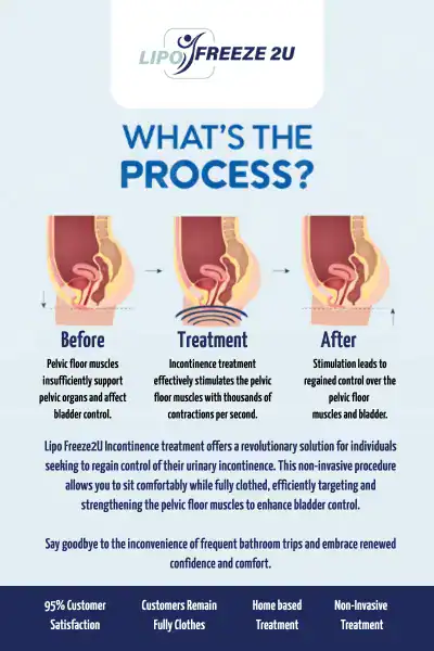 Diagram of how incontinence treatment Ashford works.