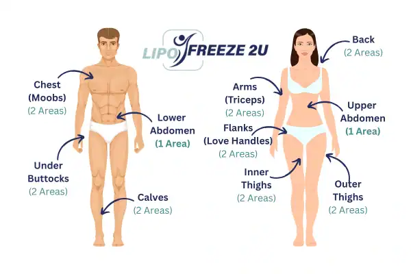 Areas you can have fat freezing treatment Ashford