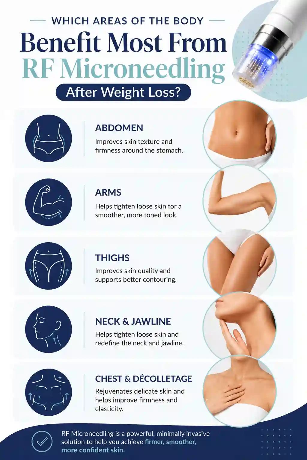 Which Areas of the Body Benefit Most From RF Microneedling After Weight Loss Ashford